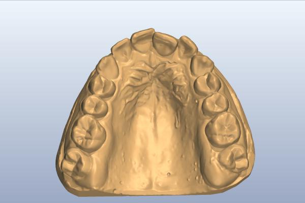 Prima del trattamento - 2