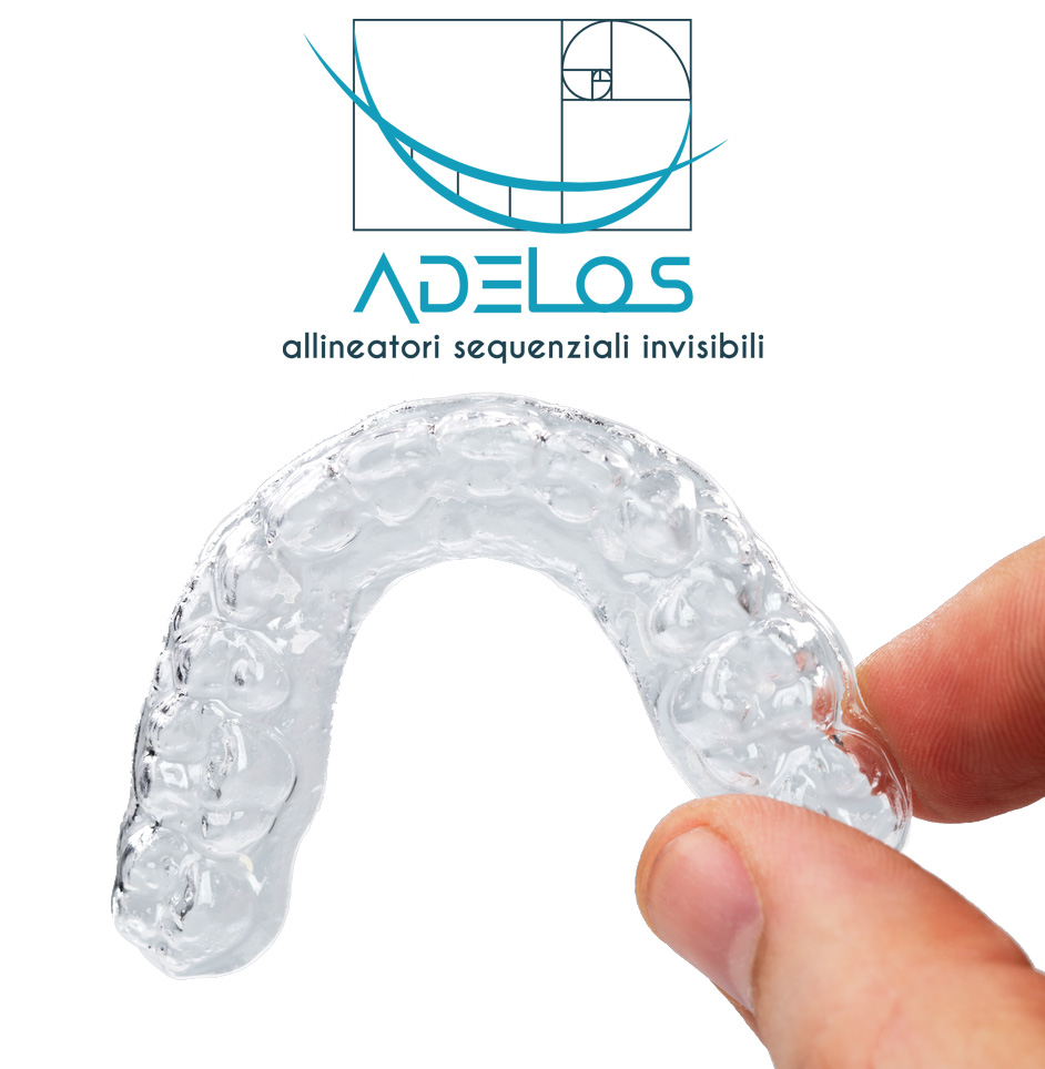 Mascherine dentali allineamento denti - allineatori sequenziali invisibili